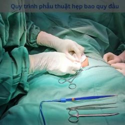https://phongkhamdakhoaquoctevietsing.vn/wp-content/uploads/2024/07/Quy-trinh-phau-thuat-hep-bao-quy-dau-250x250.jpg