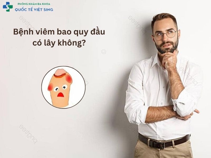 Viêm bao quy đầu có lây không?