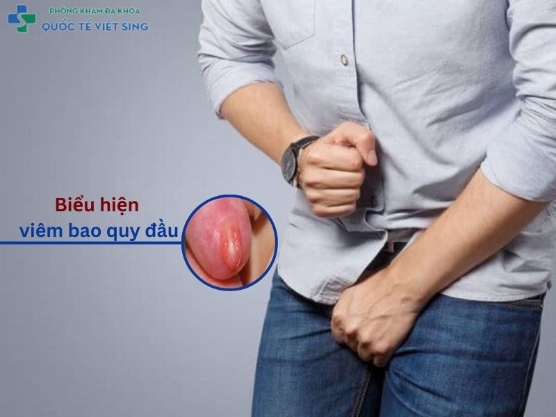 biểu hiện viêm bao quy đầu