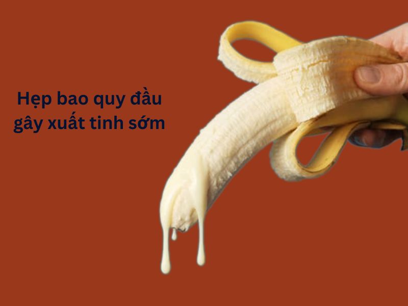 Hẹp bao quy đầu gây xuất tinh sớm