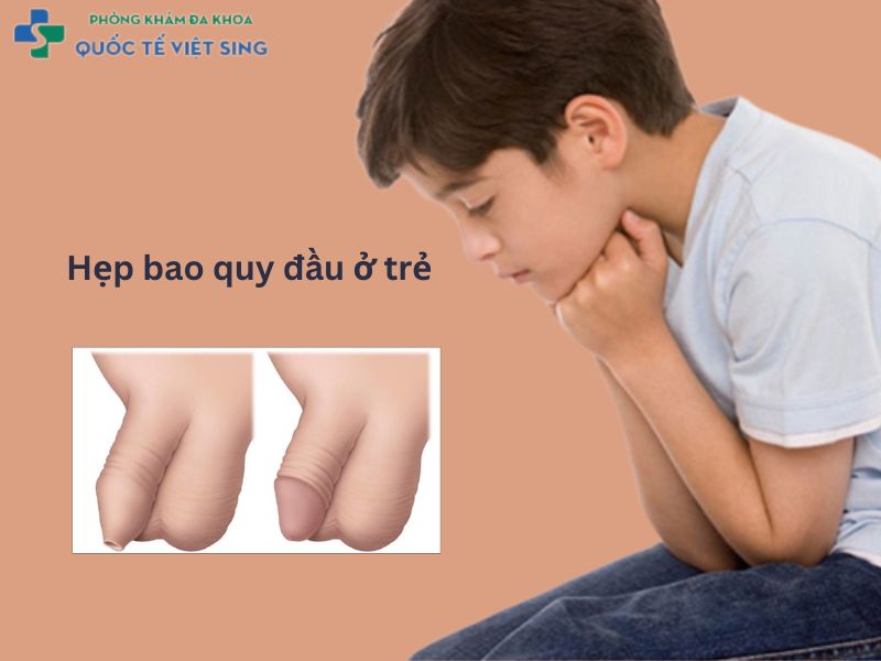 hẹp bao quy đầu ở trẻ