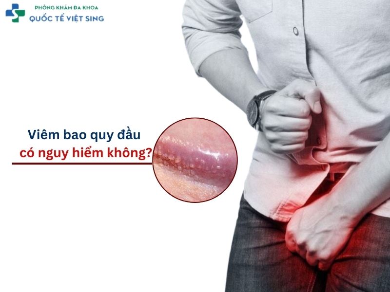 Viêm bao quy đầu có nguy hiểm không