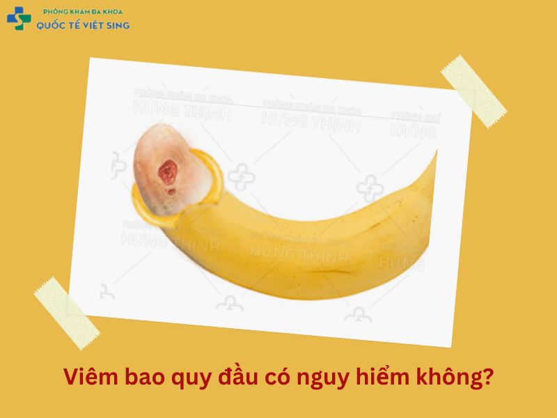 Viêm bao quy đầu có nguy hiểm không?