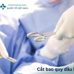 Bác sĩ giải đáp chi tiết: Cắt bao quy đầu là gì? 